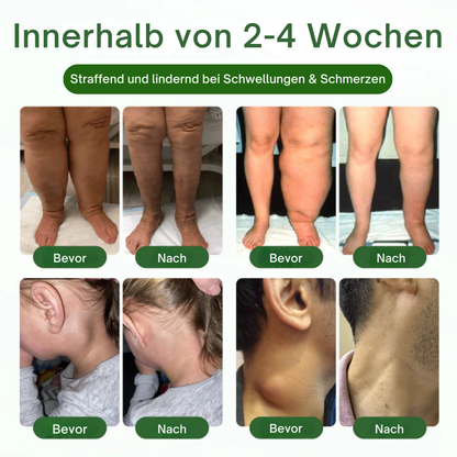 NovaRX® KörperentLastung Zirkulation Creme