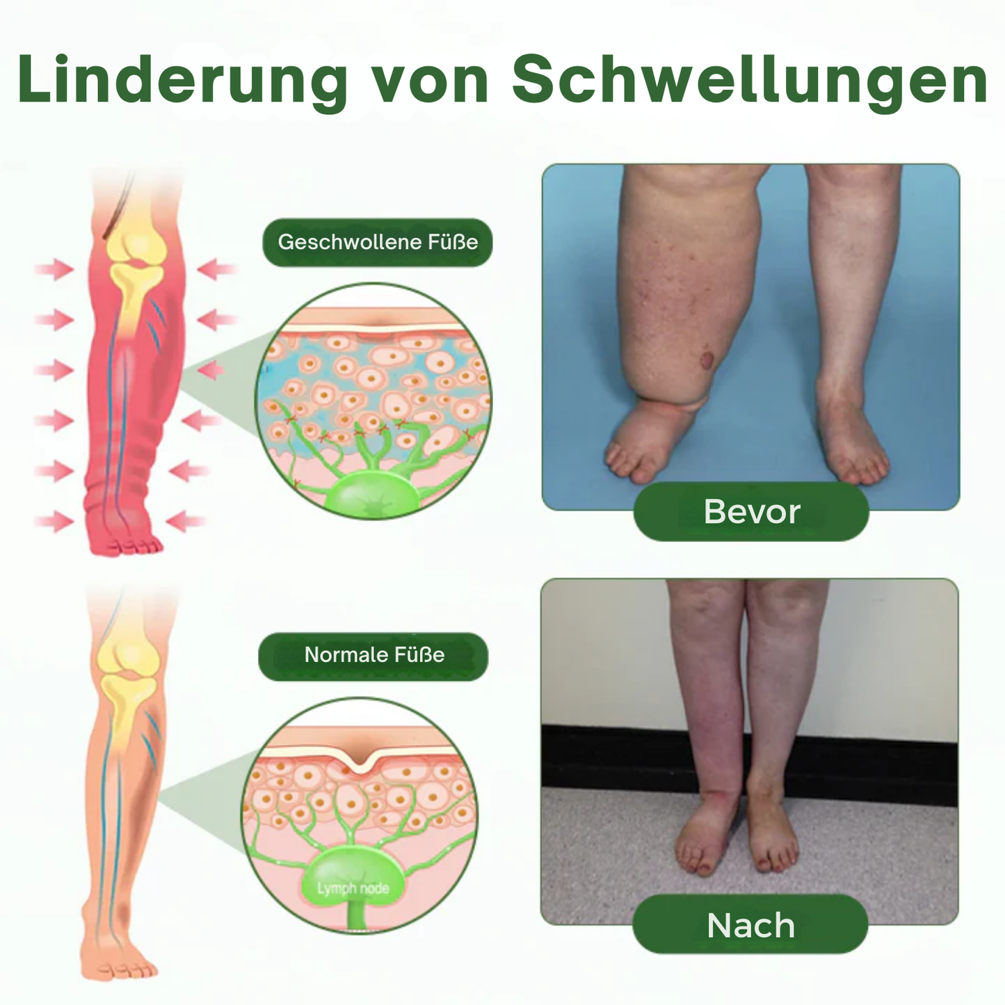 NovaRX® KörperentLastung Zirkulation Creme