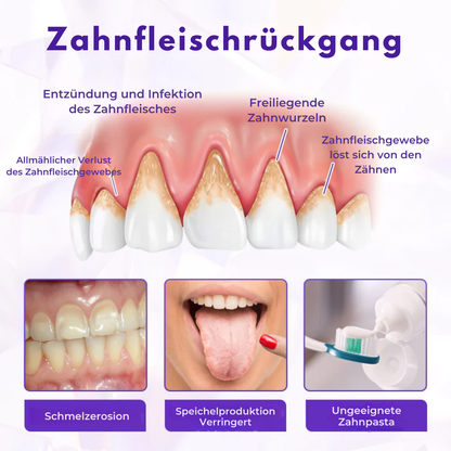 Fivfivgo® BeeRenew Fortschrittlich Zahnfleischheilende Zahnpasta