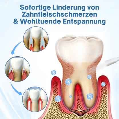 Fivfivgo® ZahnfleischEntlastung Natürliches Spray