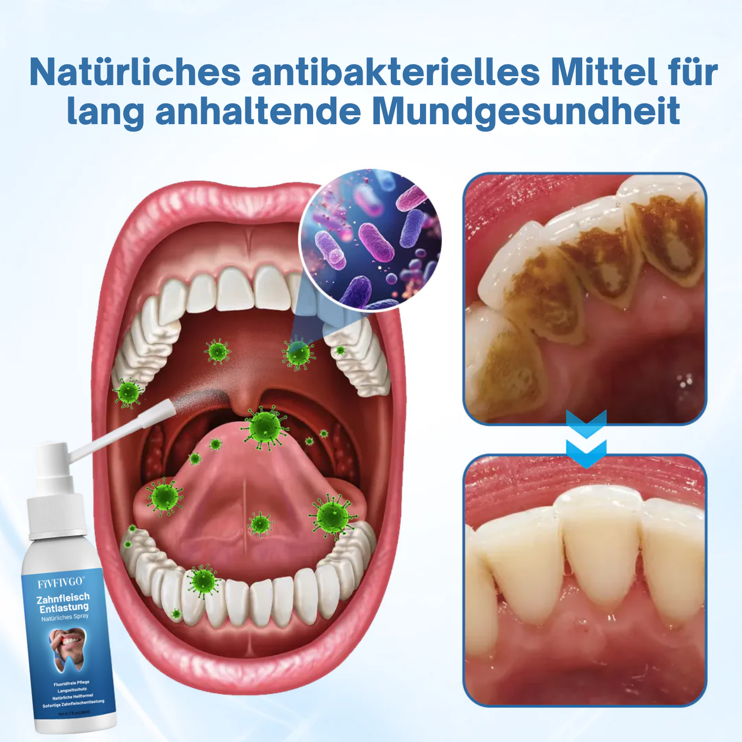 Fivfivgo® ZahnfleischEntlastung Natürliches Spray