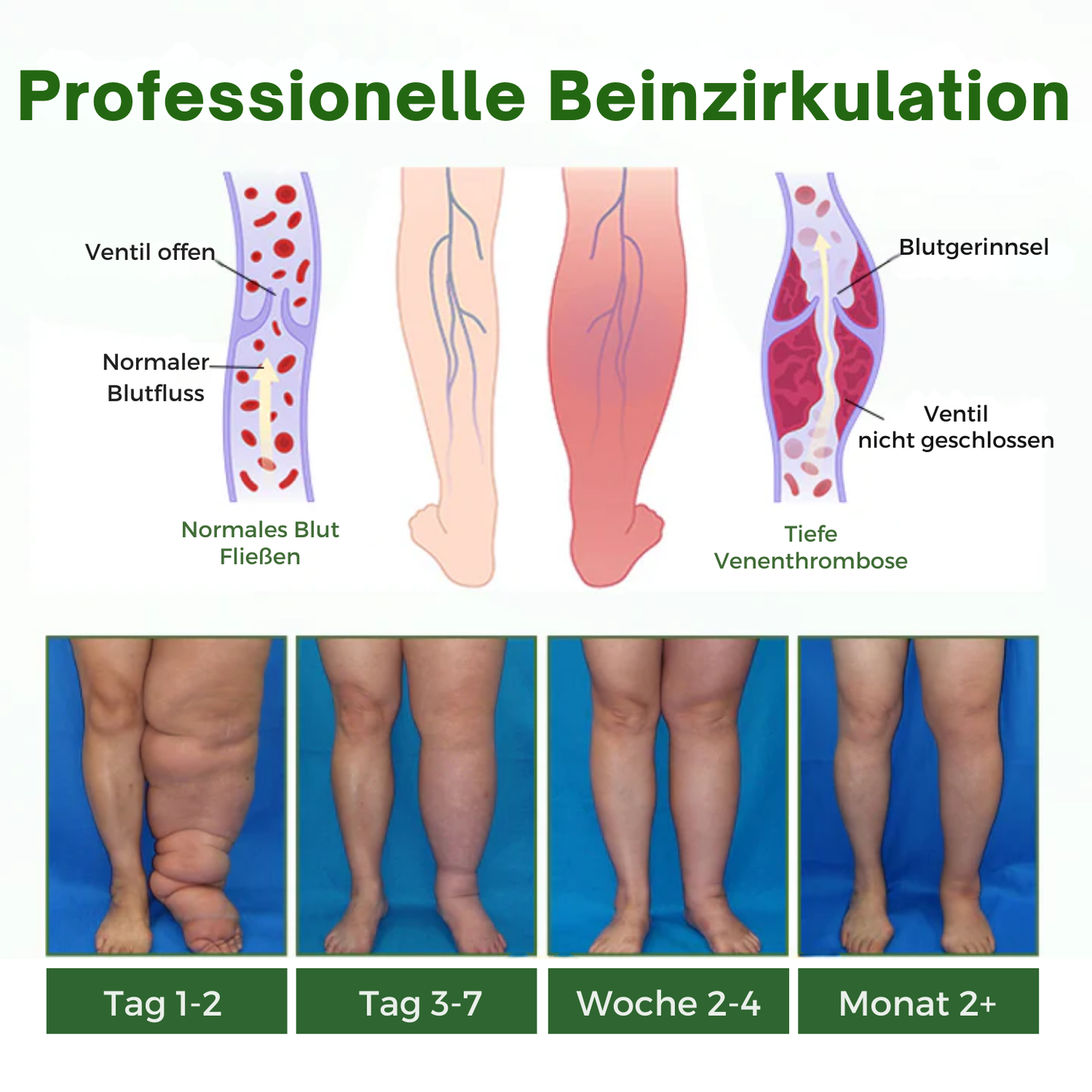 NovaRX® KörperentLastung Zirkulation Creme