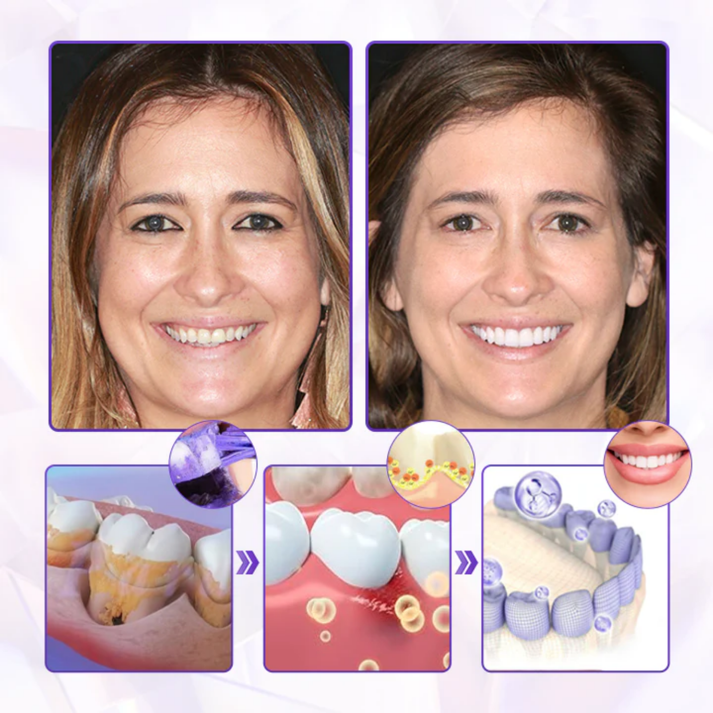 Fivfivgo® BeeRenew Fortschrittlich Zahnfleischheilende Zahnpasta