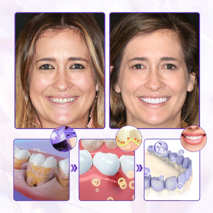 Fivfivgo® BeeRenew Fortschrittlich Zahnfleischheilende Zahnpasta