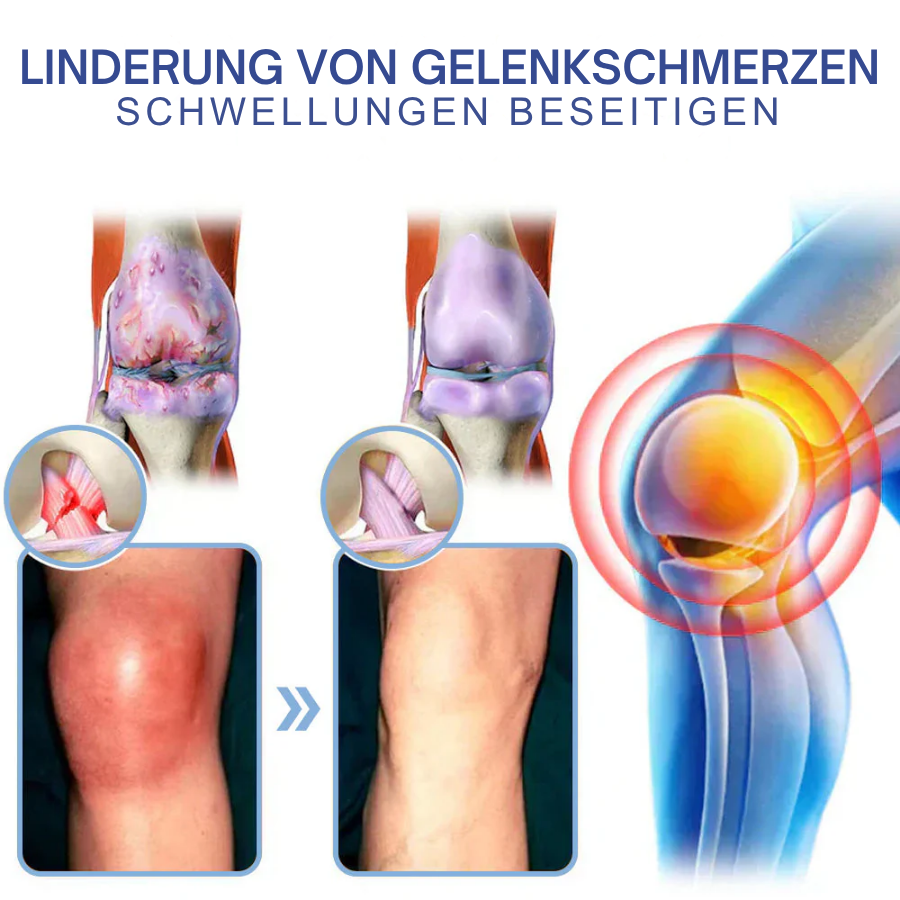 NovaRX® Fortschrittliche Magnesium-Schmerzlinderungscreme