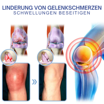 NovaRX® Fortschrittliche Magnesium-Schmerzlinderungscreme