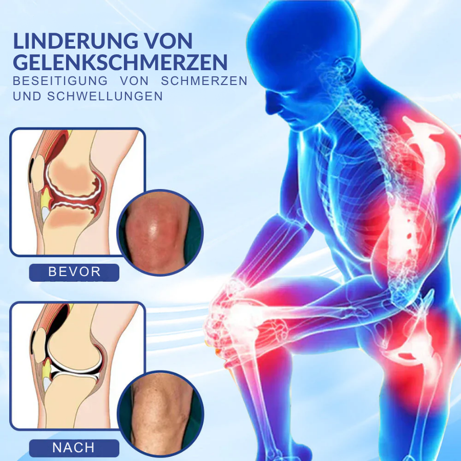 NovaRX® Fortschrittliche Magnesium-Schmerzlinderungscreme