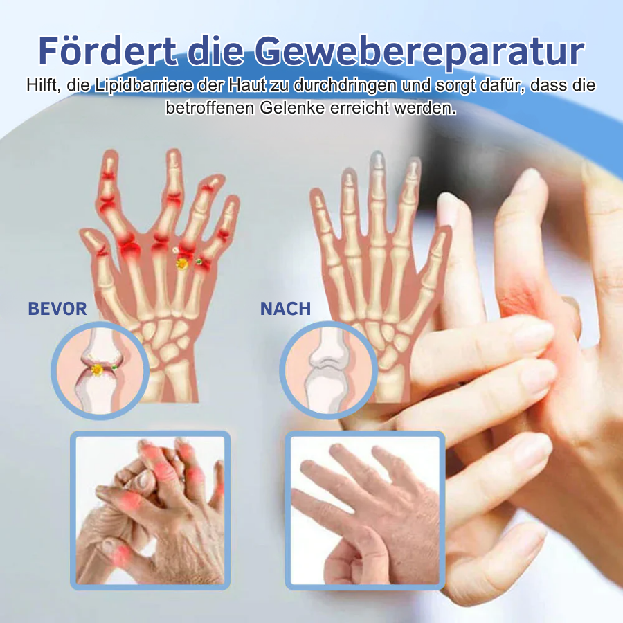 NovaRX® Fortschrittliche Magnesium-Schmerzlinderungscreme