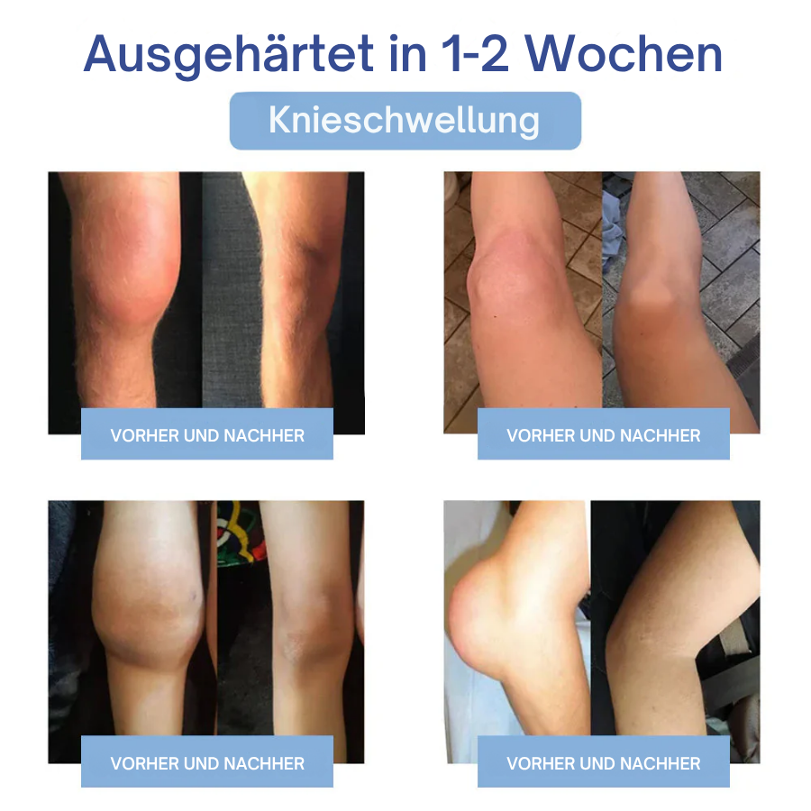 NovaRX® Fortschrittliche Magnesium-Schmerzlinderungscreme