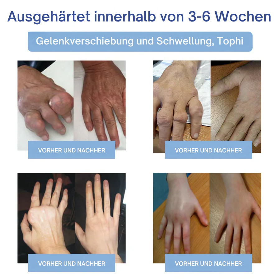 NovaRX® Fortschrittliche Magnesium-Schmerzlinderungscreme