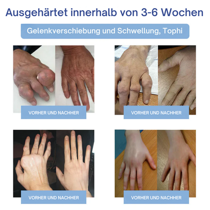 NovaRX® Fortschrittliche Magnesium-Schmerzlinderungscreme