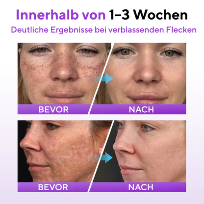 Fivfivgo® SpotErase Probiotisches Schutzserum