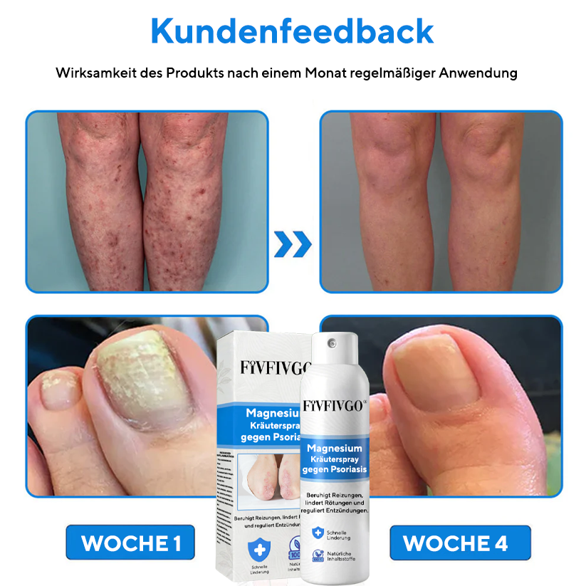 Fivfivgo® Magnesium-Kräuterspray gegen Psoriasis