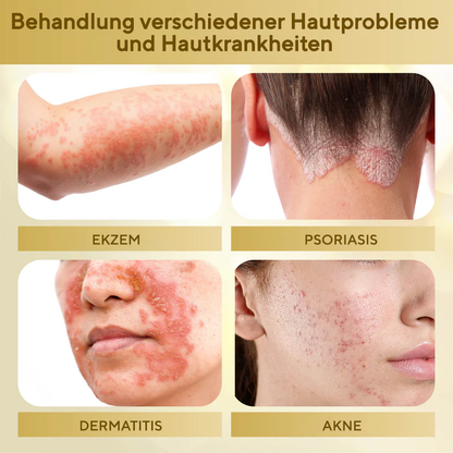 Fivfivgo® Condense Mellifera Gift Hautregenerierende Creme