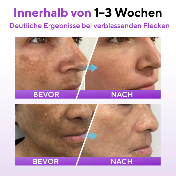 Fivfivgo® SpotErase Probiotisches Schutzserum