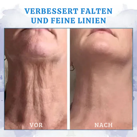 Fivfivgo® Ultra straffende und revitalisierende Creme (erneuert die Festigkeit der Haut)