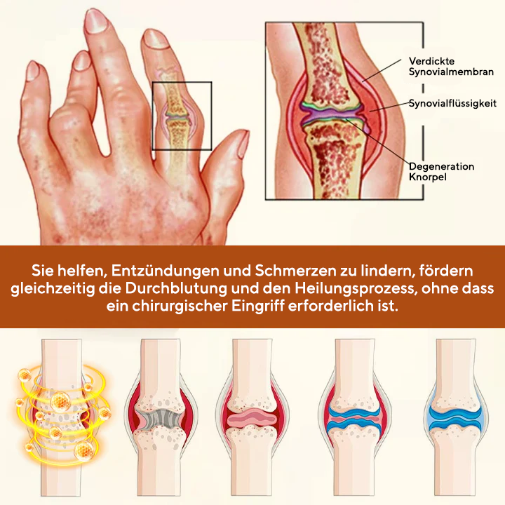 NovaRX® VenomEase Gelenkcreme