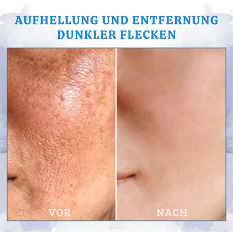 Fivfivgo® Ultra straffende und revitalisierende Creme (erneuert die Festigkeit der Haut)