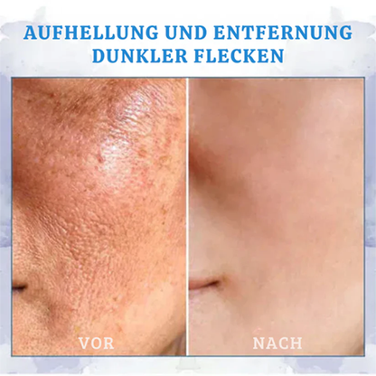 Fivfivgo® Ultra straffende und revitalisierende Creme (erneuert die Festigkeit der Haut)