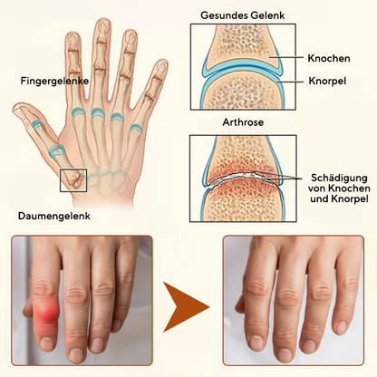 NovaRX® VenomEase Gelenkcreme