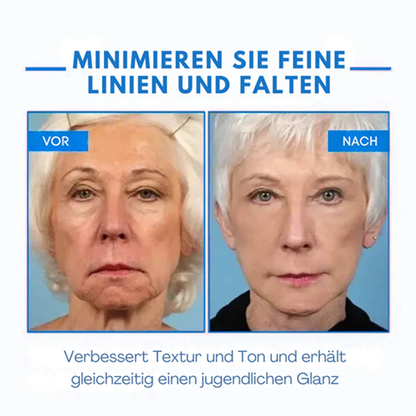 Fivfivgo® Ultra straffende und revitalisierende Creme (erneuert die Festigkeit der Haut)