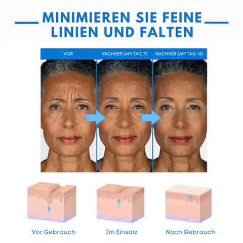 Fivfivgo® Ultra straffende und revitalisierende Creme (erneuert die Festigkeit der Haut)