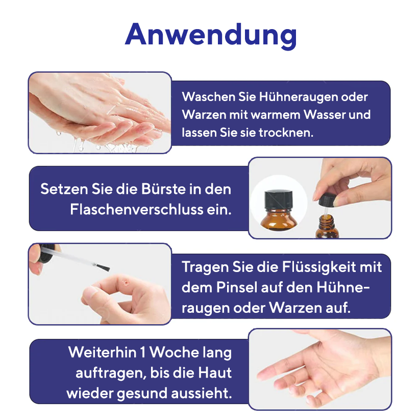 Fivfivgo® Warzen-Entferner Pro