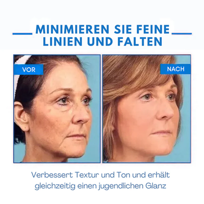 Fivfivgo® Ultra straffende und revitalisierende Creme (erneuert die Festigkeit der Haut)