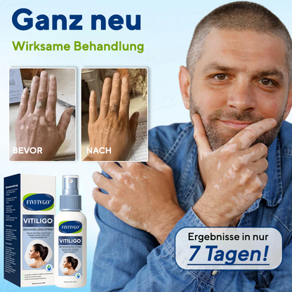 Fivfivgo® Vitiligo Behandlung Spray