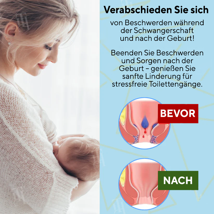 Kombinationstherapie: Cvreoz® Pflanzliches Hämorrhoiden-Behandlungsspray für den Analbereich + Reinigungstücher – Für Schwangerschaft und Wochenbett geeignet