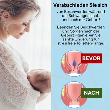 Kombinationstherapie: Cvreoz® Pflanzliches Hämorrhoiden-Behandlungsspray für den Analbereich + Reinigungstücher – Für Schwangerschaft und Wochenbett geeignet