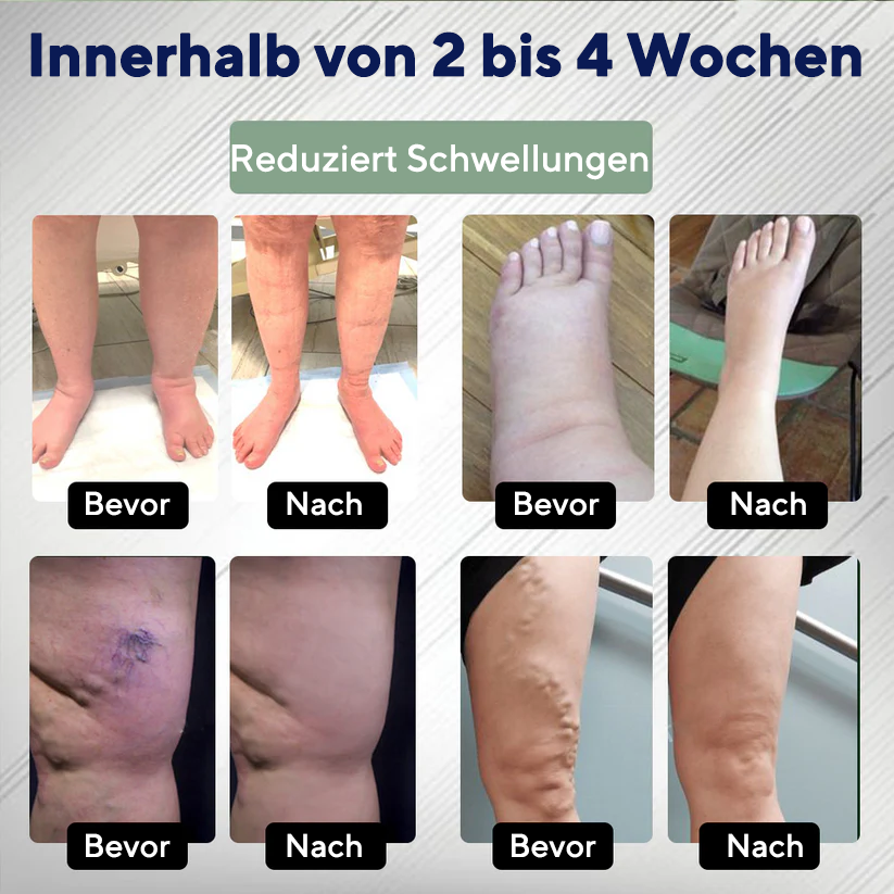 NovaRX® FlowBoost Ödem-Drainage Kräuter-Roll-on