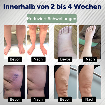 NovaRX® FlowBoost Ödem-Drainage Kräuter-Roll-on