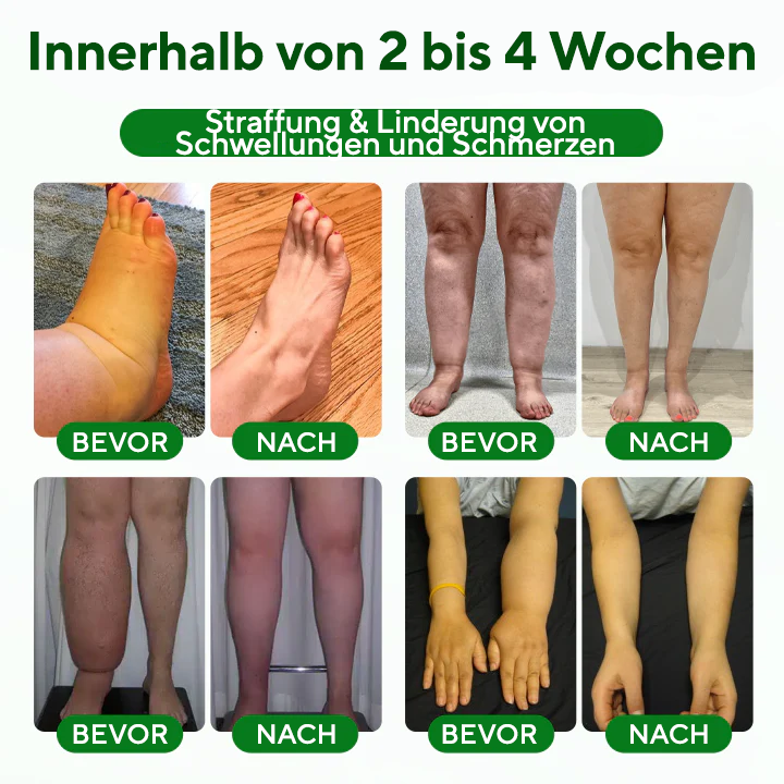 NovaRX® VenoLift Bein-Entlastungsspray