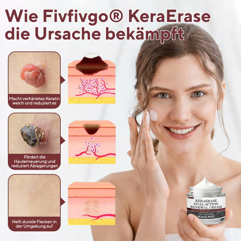 Fivfivgo® KeraErase Dual-Action Erneuerungscreme
