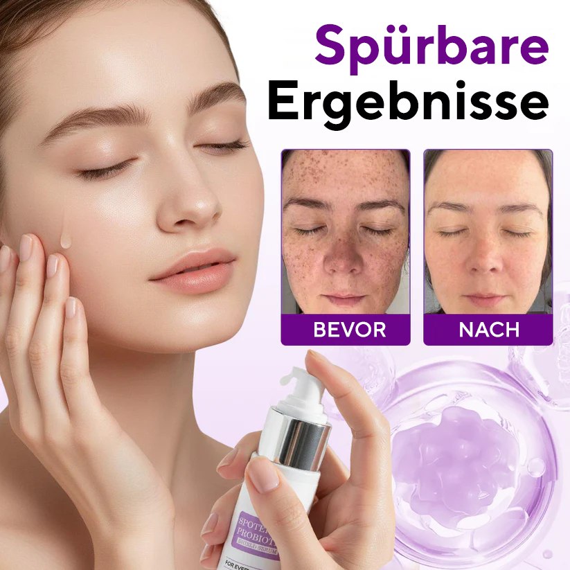 Fivfivgo® SpotErase Probiotisches Schutzserum