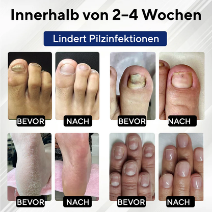 Fivfivgo® FungaGuard Botanica Roll-On-Stick