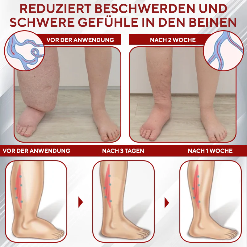 NovaRX® Rotweinstock FluidRelief Ödem-Gel