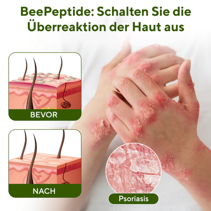 Fivfivgo® BeePeptide RootSoft DualRelief Creme