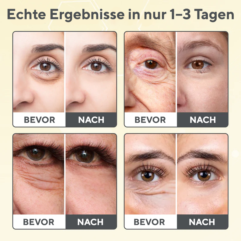 Fivfivgo® Die 7-Tage-V-Line-Kur: Vita A Retinal straffendes Serum