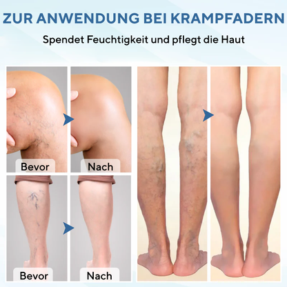 NovaRX® TheraVein Kräuterspray gegen Krampfadern
