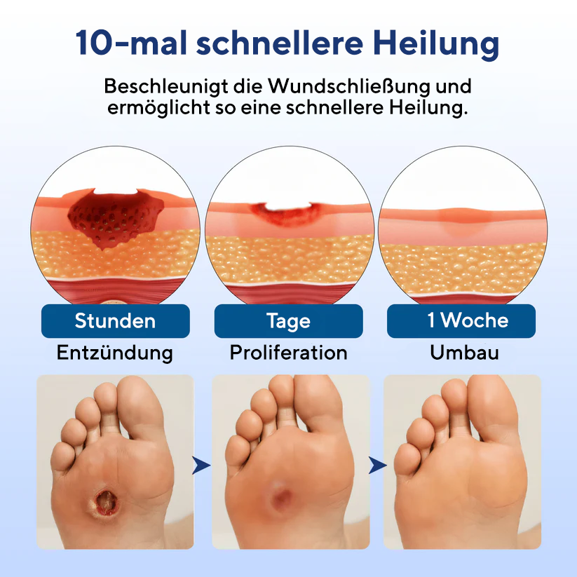 Cvreoz® UltraHeal Fußcreme für Diabetiker