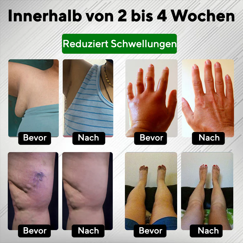 NovaRX® PuffyGone Rosskastanien-Ödemcreme