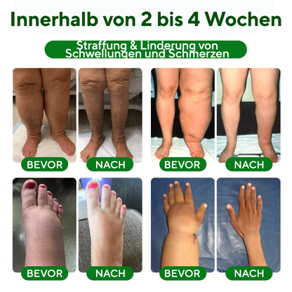 NovaRX® VenoLift Bein-Entlastungsspray