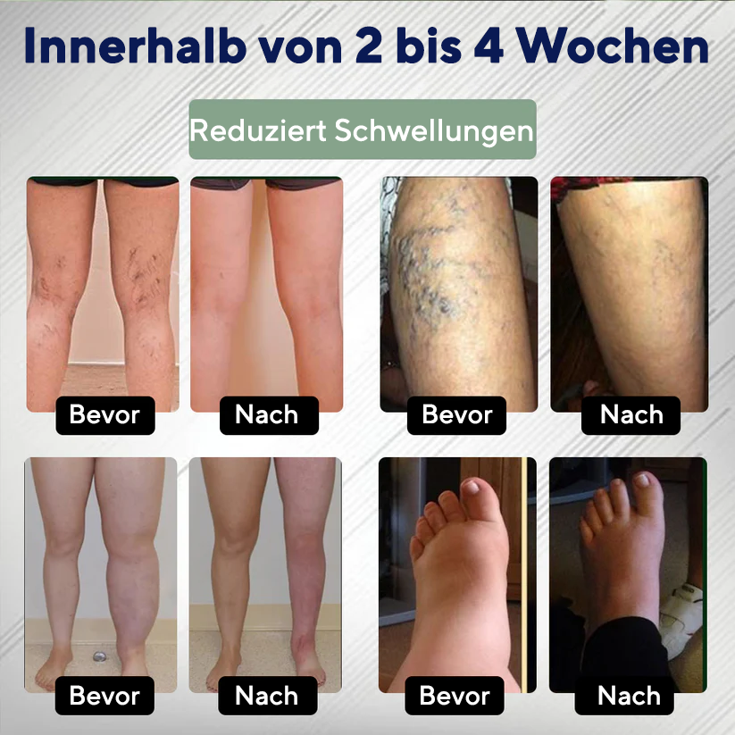 NovaRX® FlowBoost Ödem-Drainage Kräuter-Roll-on