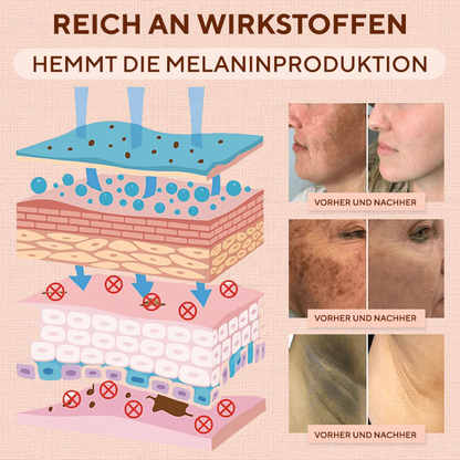 Fivfivgo® Reinigendes Peeling-Gel für Acanthosis Nigricans, Peeling, dunkle Flecken, Hautflecken und Ekzeme