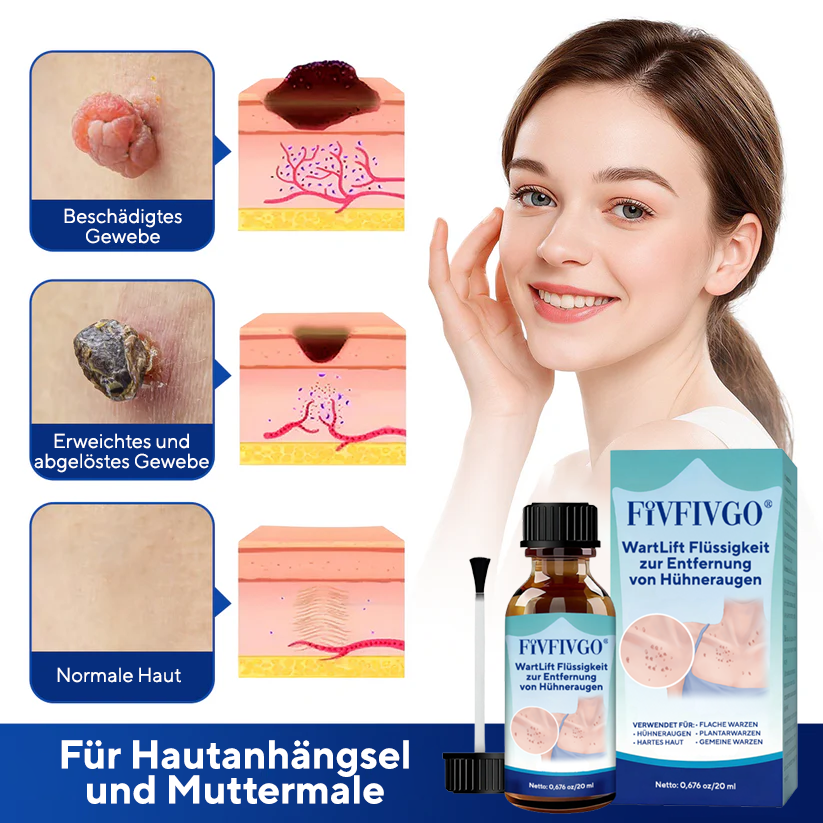 Fivfivgo® WartLift Flüssigkeit zur Entfernung von Hühneraugen