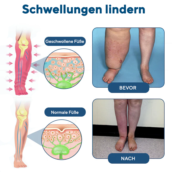 NovaRX® Roll-On-Pumpcreme für Lymphdrainage und Linderung von Schwellungen