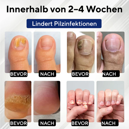 Fivfivgo® FungaGuard Botanica Roll-On-Stick