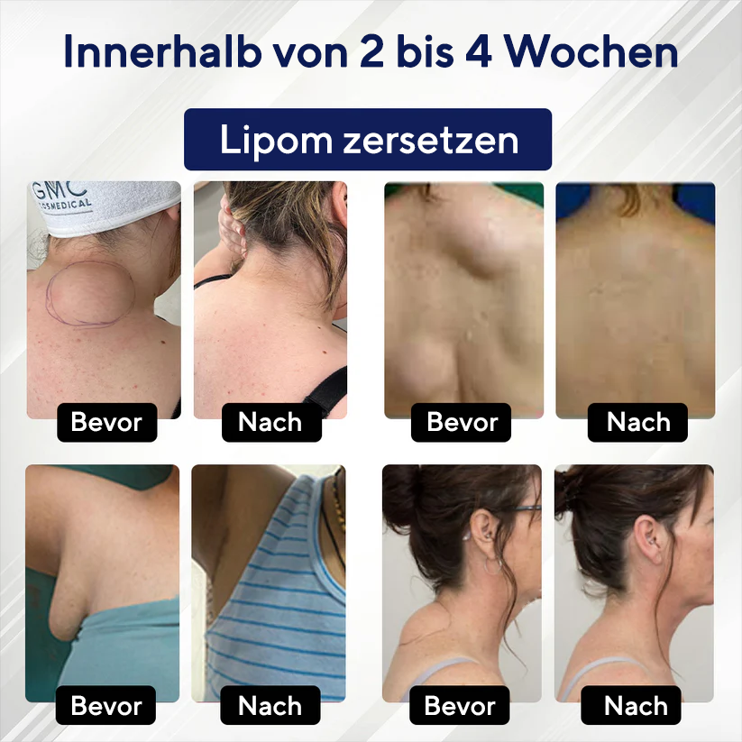 Fivfivgo®  LipoEase Kräuter-Matrix-4-Creme